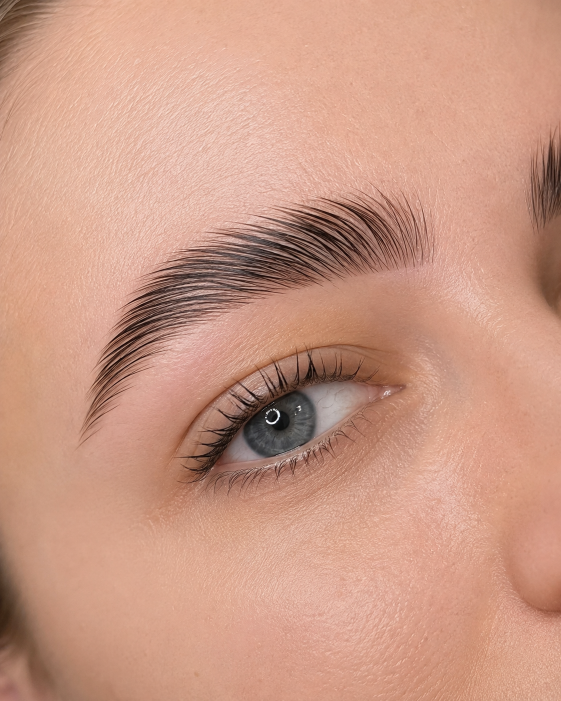 BROW LIFTING